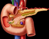 Chronic Pancreatitis (CP)