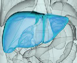 Hepatic Fibrosis (HF)