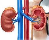 Actue Renal Failure (ARF)