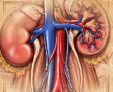 Renal Ischemia-Reperfusion Injury (RIRI)