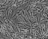 Myometrial Smooth Muscle Cells (MSMC)