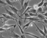 Ocular Choroid Fibroblasts (OCF)