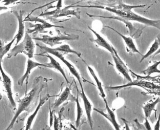 Periodontal Ligament Fibroblasts (PDLF)