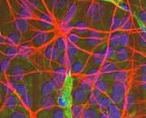 Retinal Astrocytes (RA)