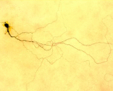 Retinal Ganglion Cells  (RGC)