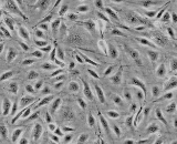 Seminal Vesicle Microvascular Endothelial Cells (SVMEC)