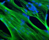 Skeletal Muscle Myoblasts (SMM)