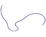 Pulmonary Surfactant Associated Protein A1 (SFTPA1)