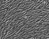 Umbilical Mesenchymal Stem Cells (UMSC)