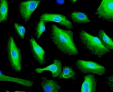 Urothelial Cells (UC)