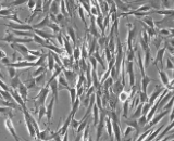 Uterine Fibroblasts (UF)