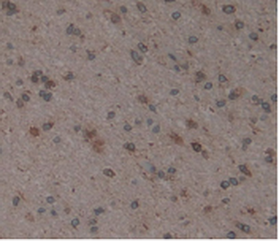 Anti-Calnexin (CNX) Polyclonal Antibody