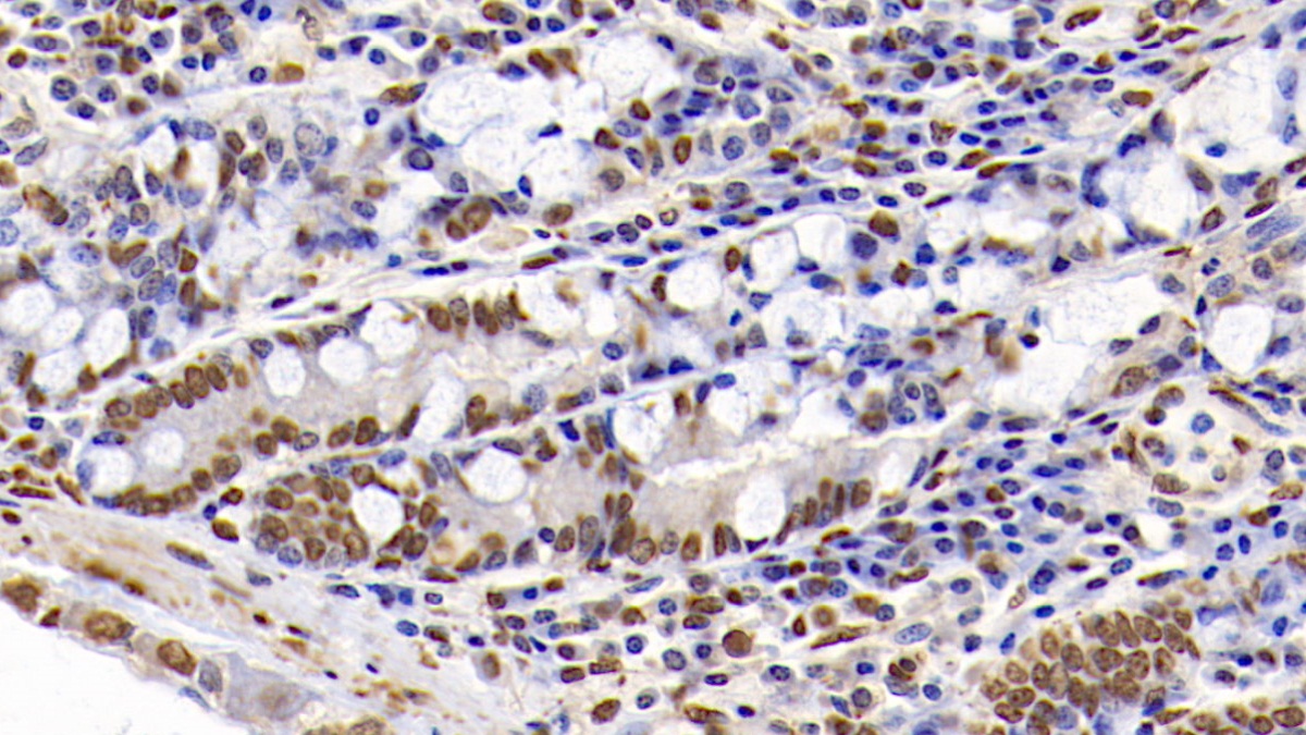 Anti-Histone H3 (H3) Polyclonal Antibody