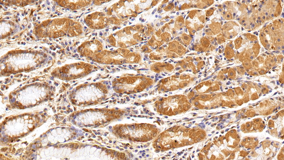 Anti-Beta Catenin (β-catenin) Polyclonal Antibody