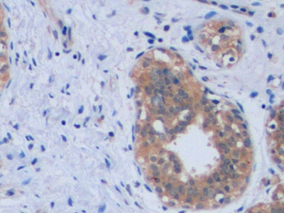 Anti-Transferrin Receptor (TFR) Monoclonal Antibody