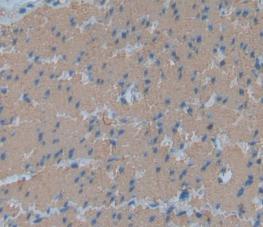 Anti-Actin Alpha 1, Cardiac Muscle (ACTC1) Polyclonal Antibody