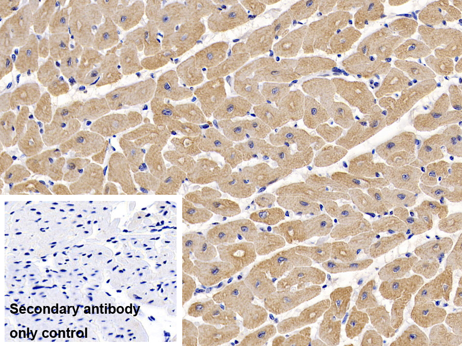 Anti-Actin Alpha 1, Cardiac Muscle (ACTC1) Monoclonal Antibody