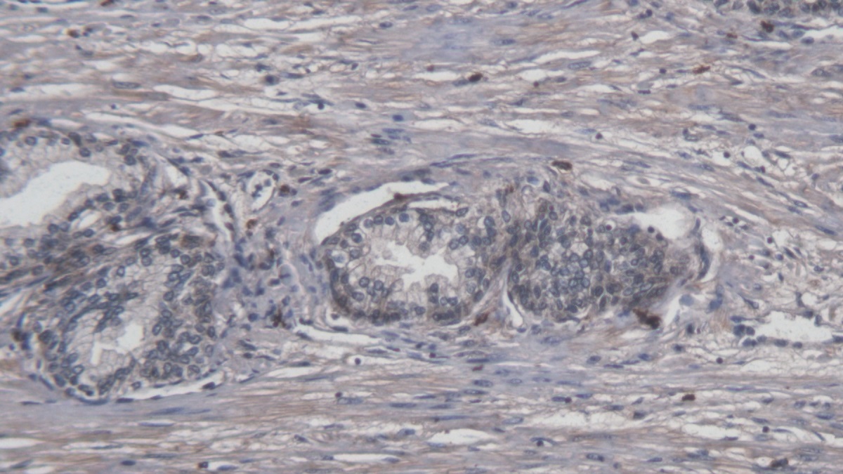 FITC-Linked Monoclonal Antibody to Interleukin 8 (IL8)