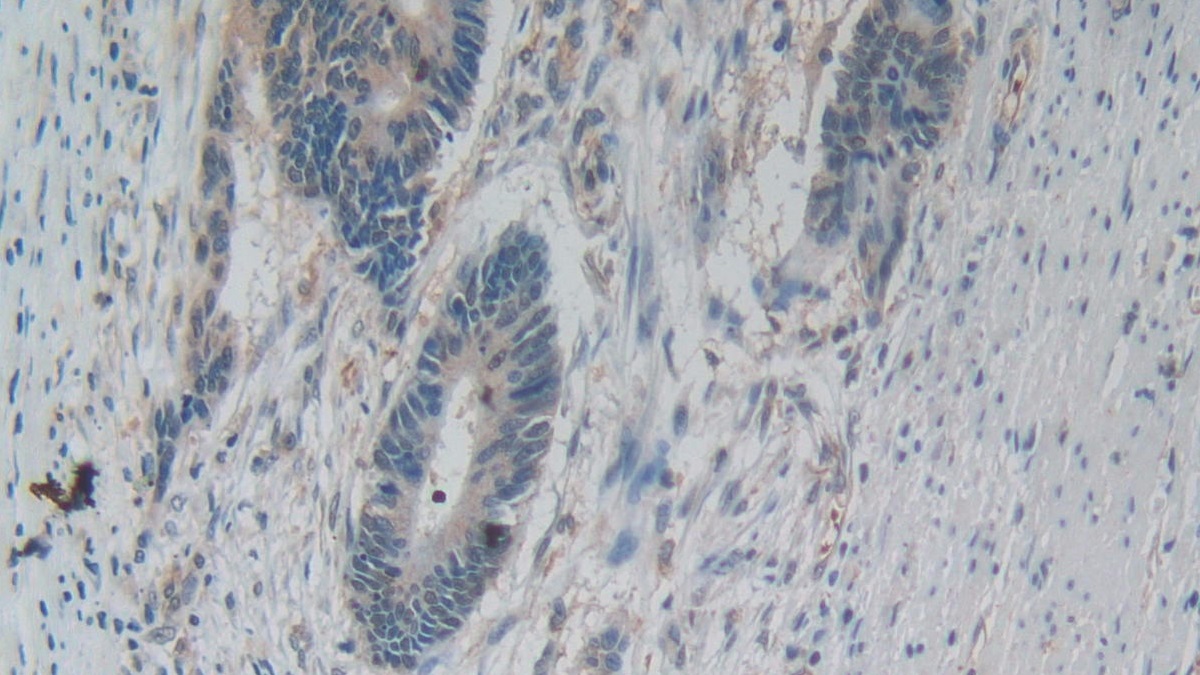 Monoclonal Antibody to Amphiregulin (AREG)