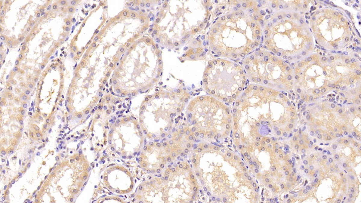 Monoclonal Antibody to Angiogenin (ANG)