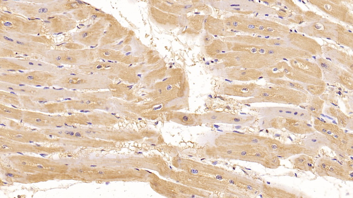 Monoclonal Antibody to Connective Tissue Growth Factor (CTGF)