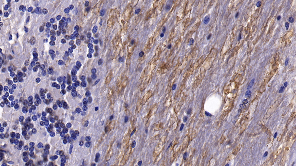 Monoclonal Antibody to Brain Derived Neurotrophic Factor (BDNF)