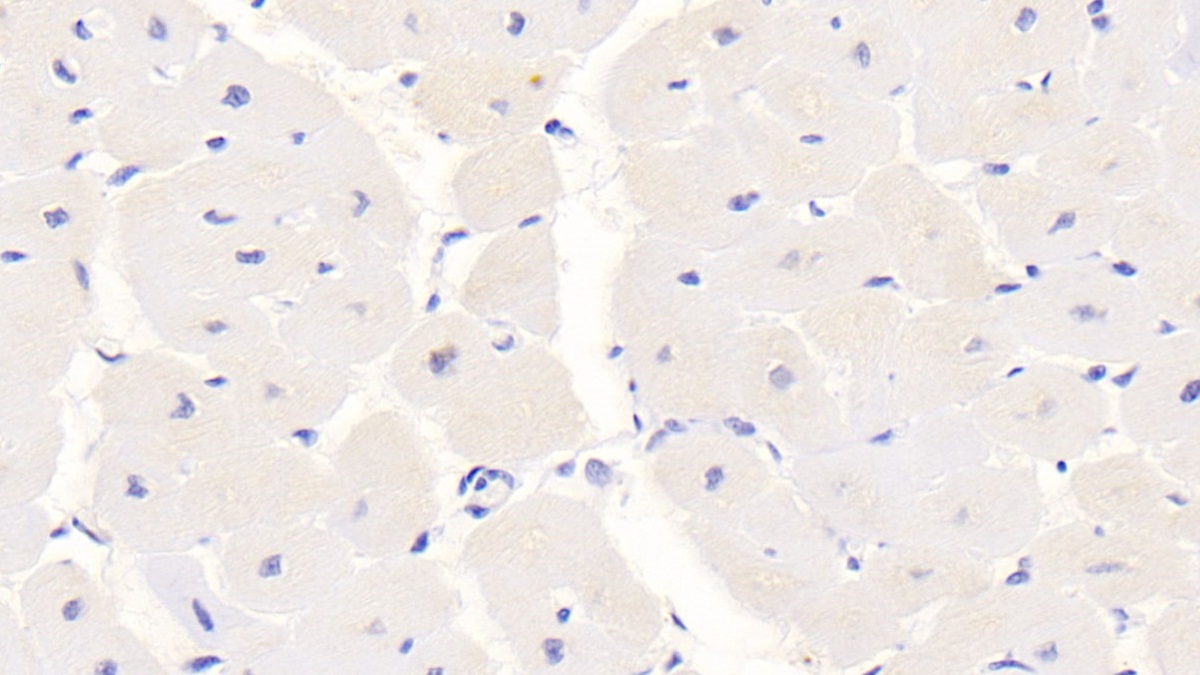 Monoclonal Antibody to S100 Calcium Binding Protein (S100)