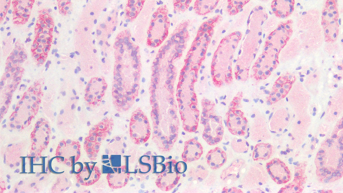 Monoclonal Antibody to E-cadherin