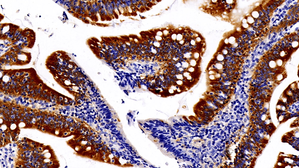 Monoclonal Antibody to Ciliary Neurotrophic Factor (CNTF)