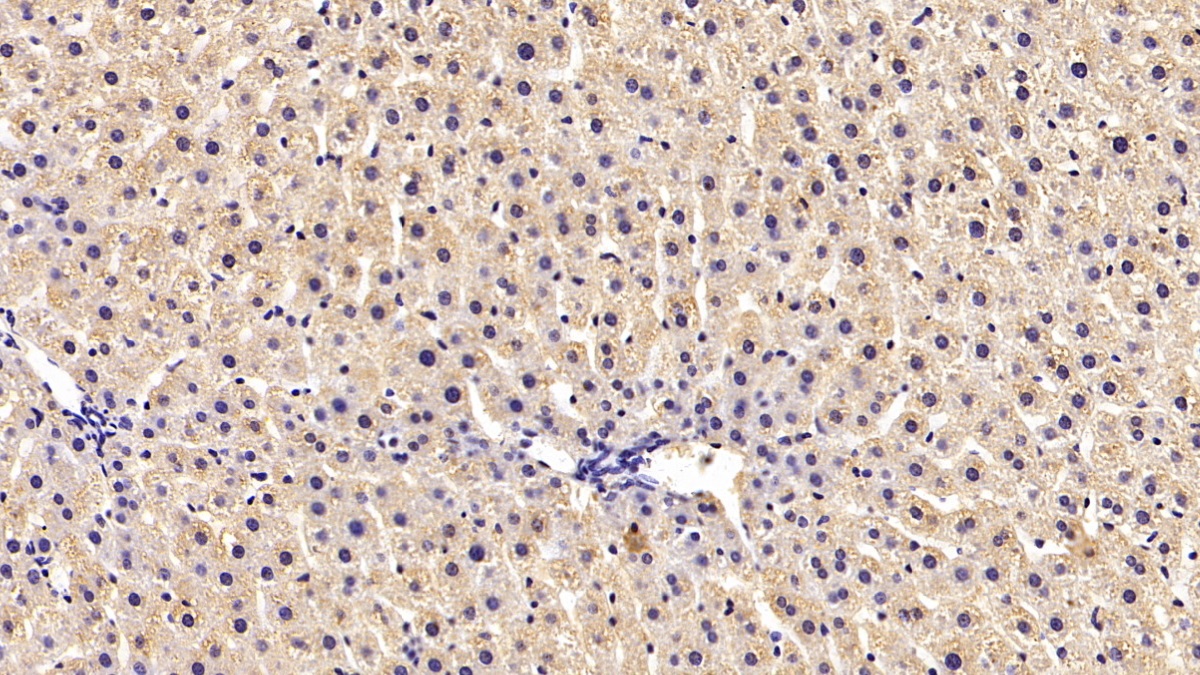 Monoclonal Antibody to Erythropoietin Receptor (EPOR)