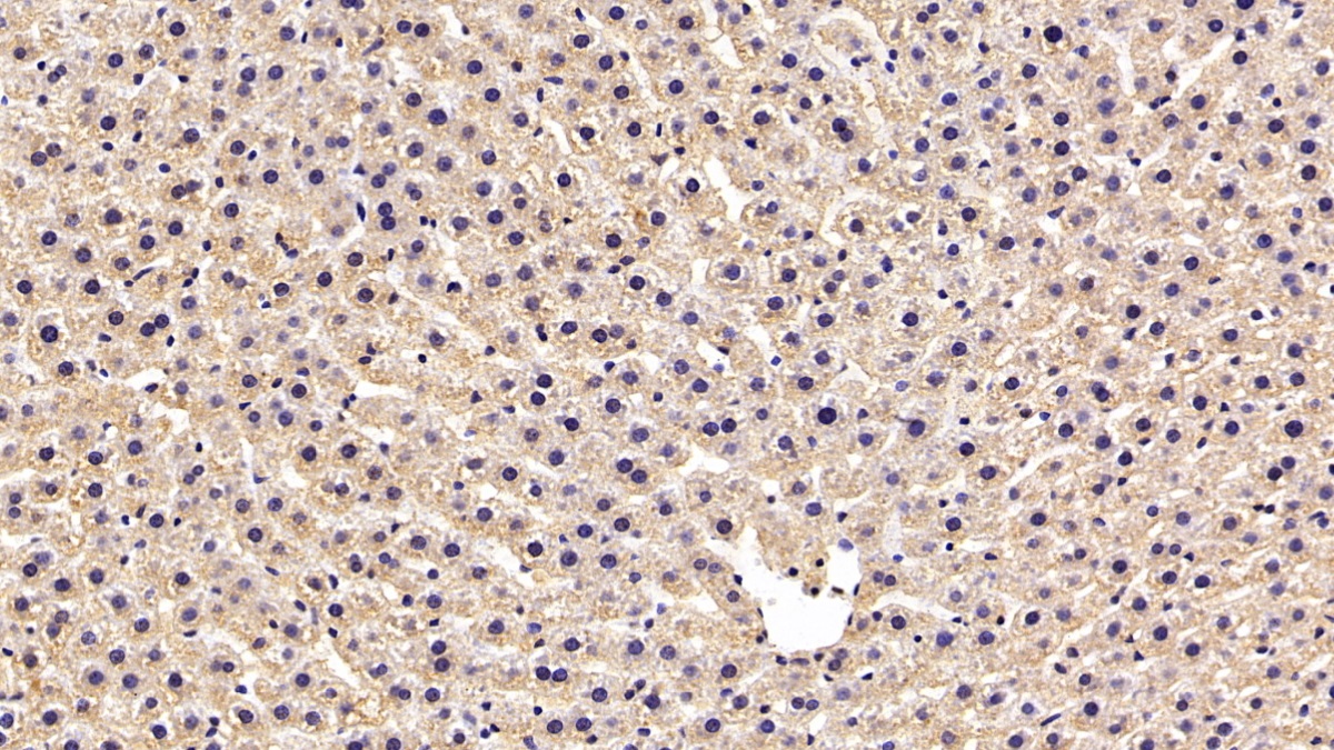 Monoclonal Antibody to Erythropoietin Receptor (EPOR)