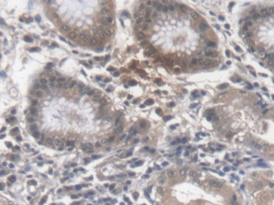 Monoclonal Antibody to Erythropoietin (EPO)