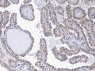 Monoclonal Antibody to Erythropoietin (EPO)