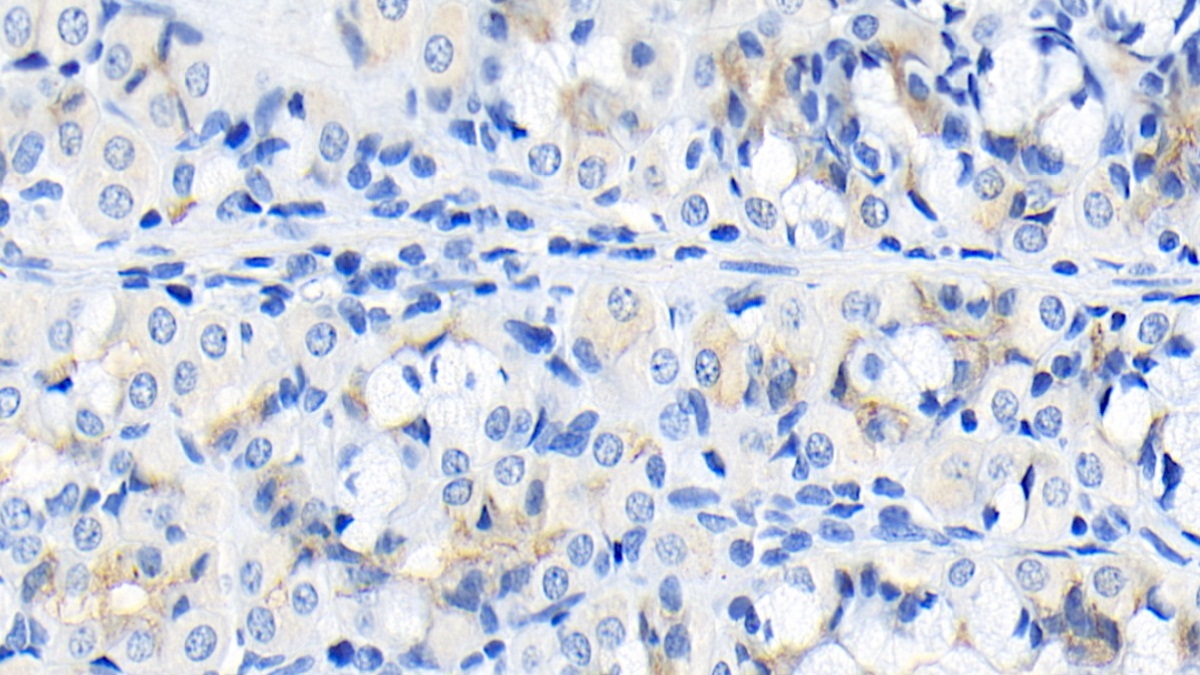 Monoclonal Antibody to Fibroblast Growth Factor 9 (FGF9)