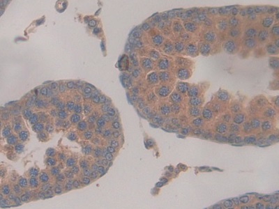 Monoclonal Antibody to Chemokine (C-X-C Motif) Ligand 1 (CXCL1)