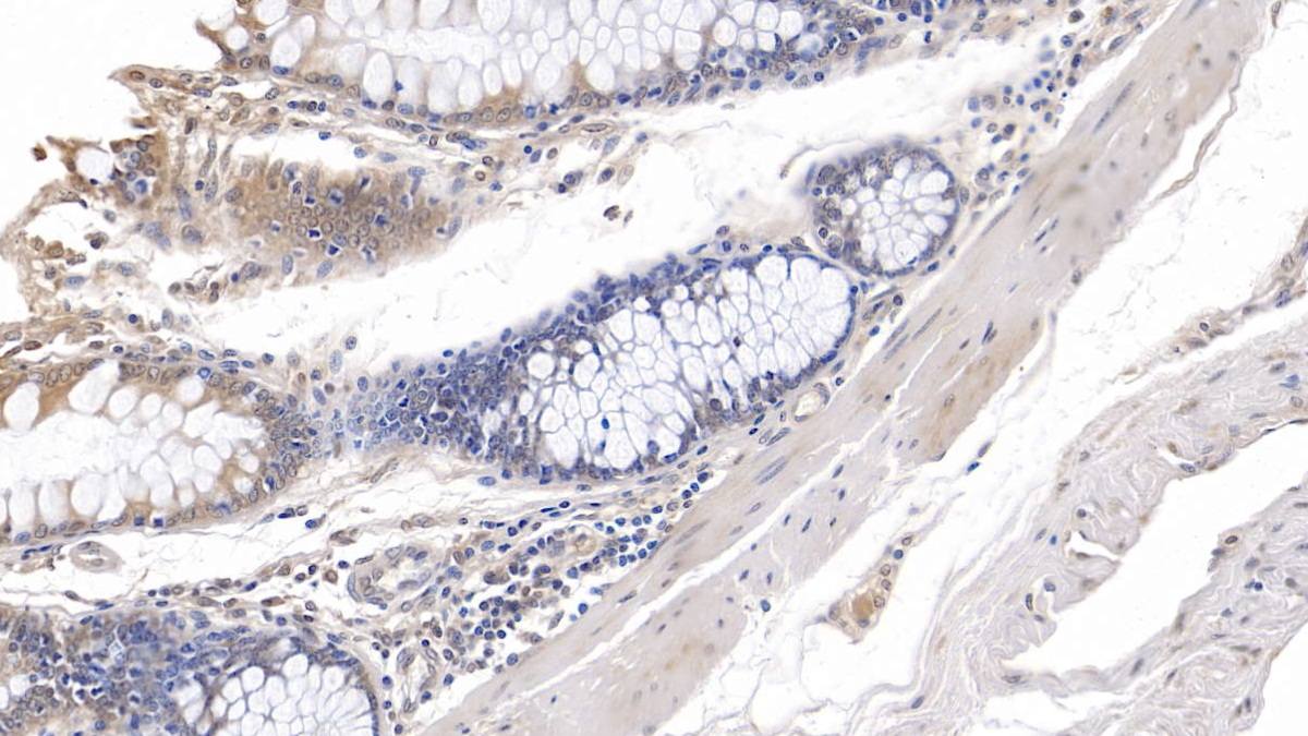 Monoclonal Antibody to Interleukin 10 (IL10)