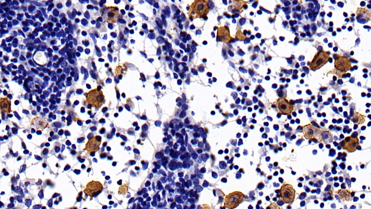 Monoclonal Antibody to Interleukin 10 (IL10)