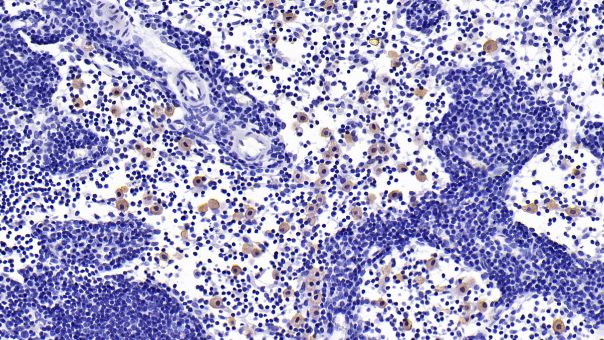 Monoclonal Antibody to Interleukin 10 (IL10)