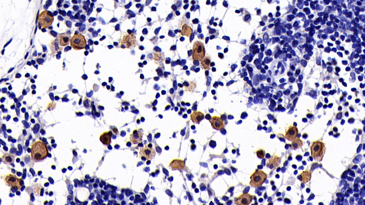 Monoclonal Antibody to Interleukin 10 (IL10)