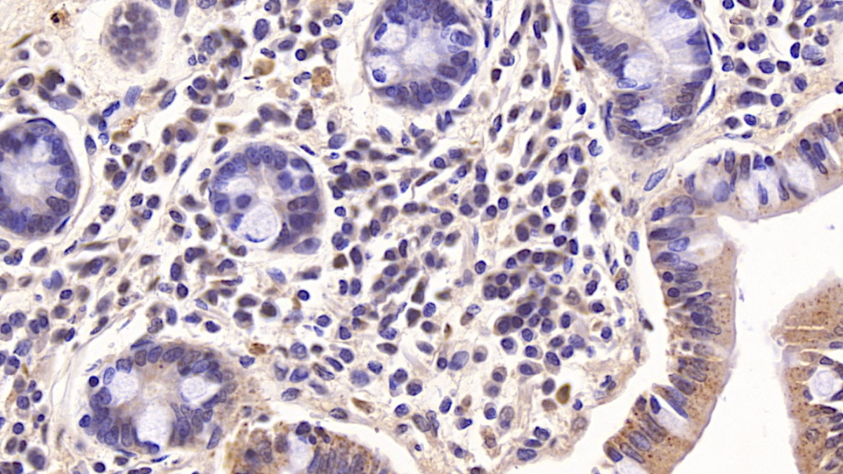 Monoclonal Antibody to Interleukin 10 (IL10)