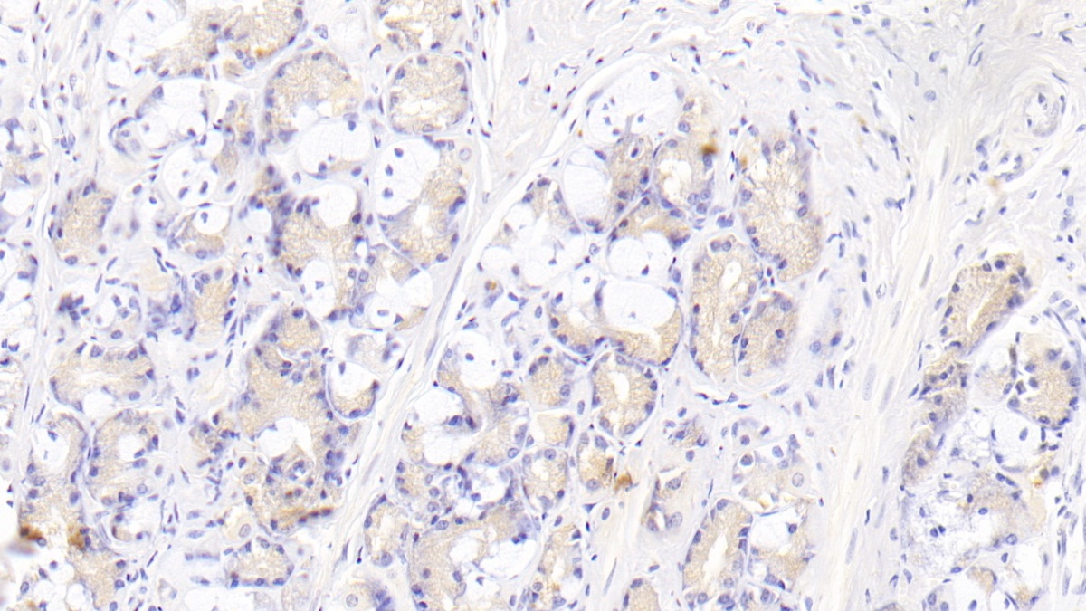 Monoclonal Antibody to Interleukin 12B (IL12B)