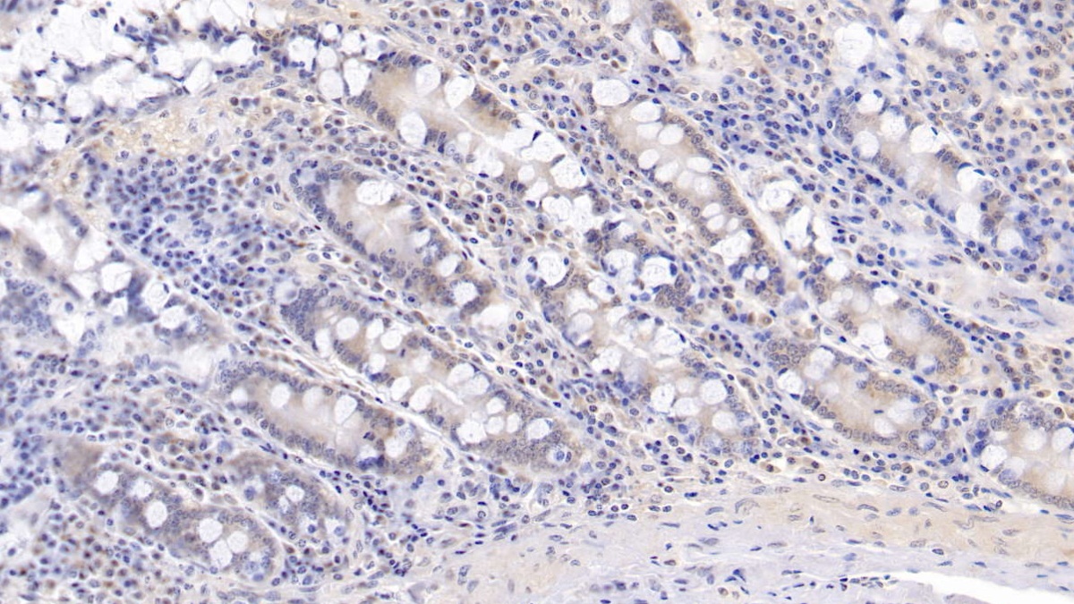 Monoclonal Antibody to Interleukin 17 (IL17)