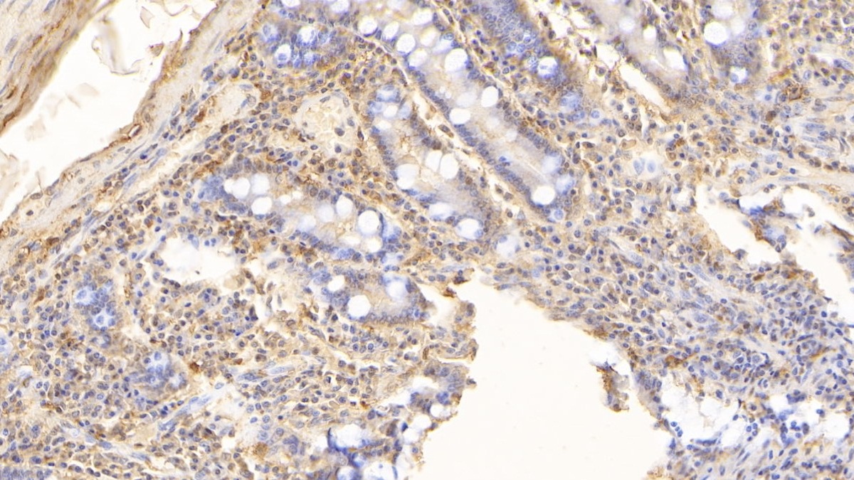 Monoclonal Antibody to Interleukin 17 (IL17)