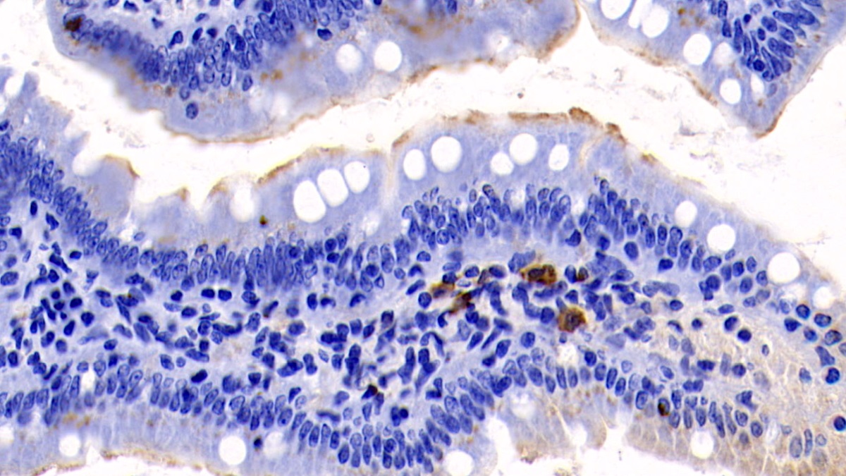 Monoclonal Antibody to Interleukin 17 (IL17)