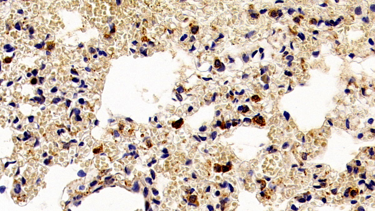 Monoclonal Antibody to Interleukin 17 (IL17)