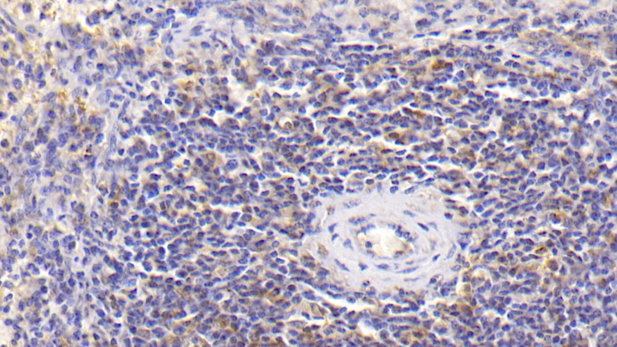 Monoclonal Antibody to Interleukin 18 (IL18)