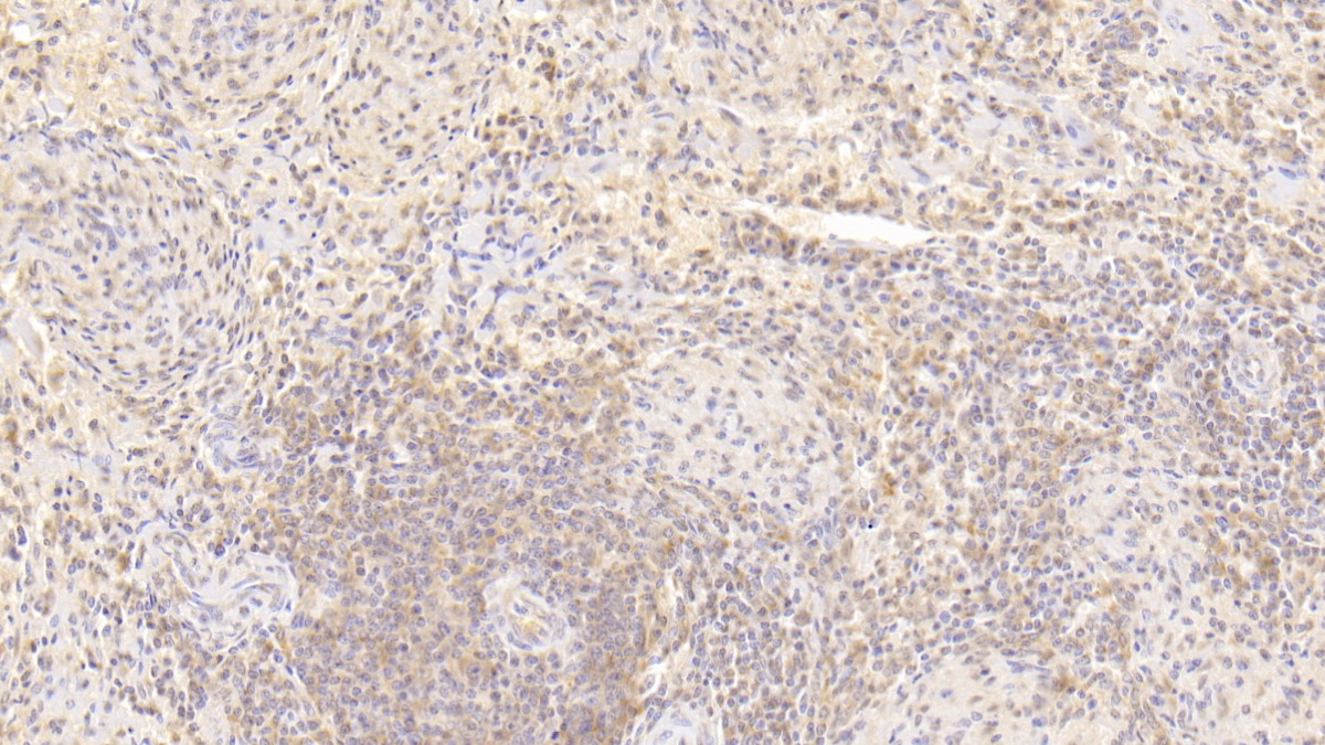 Monoclonal Antibody to Interleukin 18 (IL18)