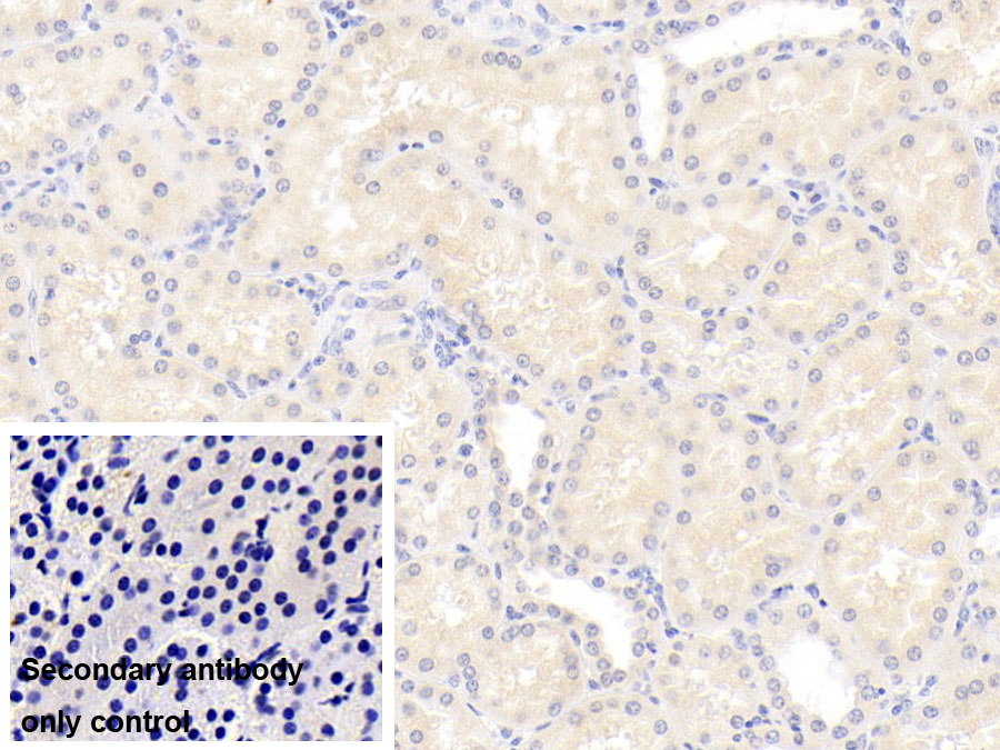 Monoclonal Antibody to Interleukin 18 (IL18)