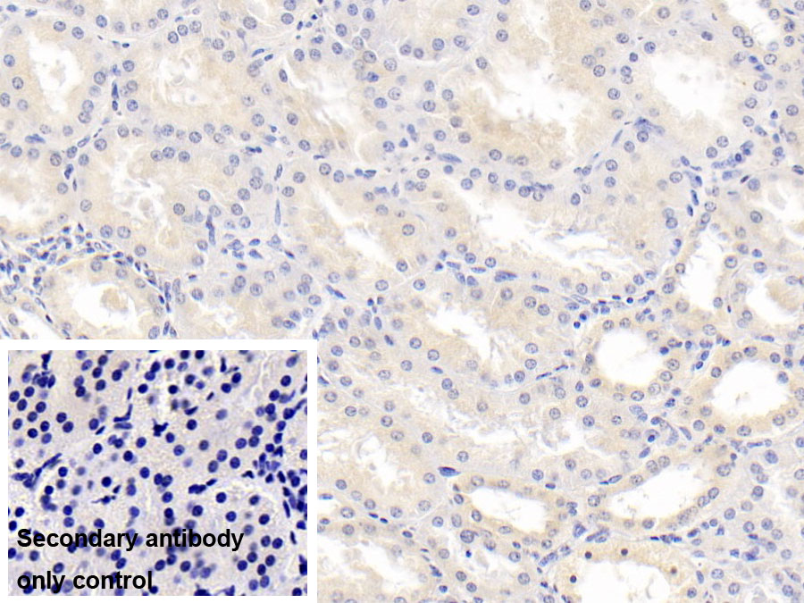 Monoclonal Antibody to Interleukin 18 (IL18)