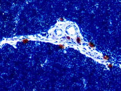 Monoclonal Antibody to Interleukin 18 (IL18)